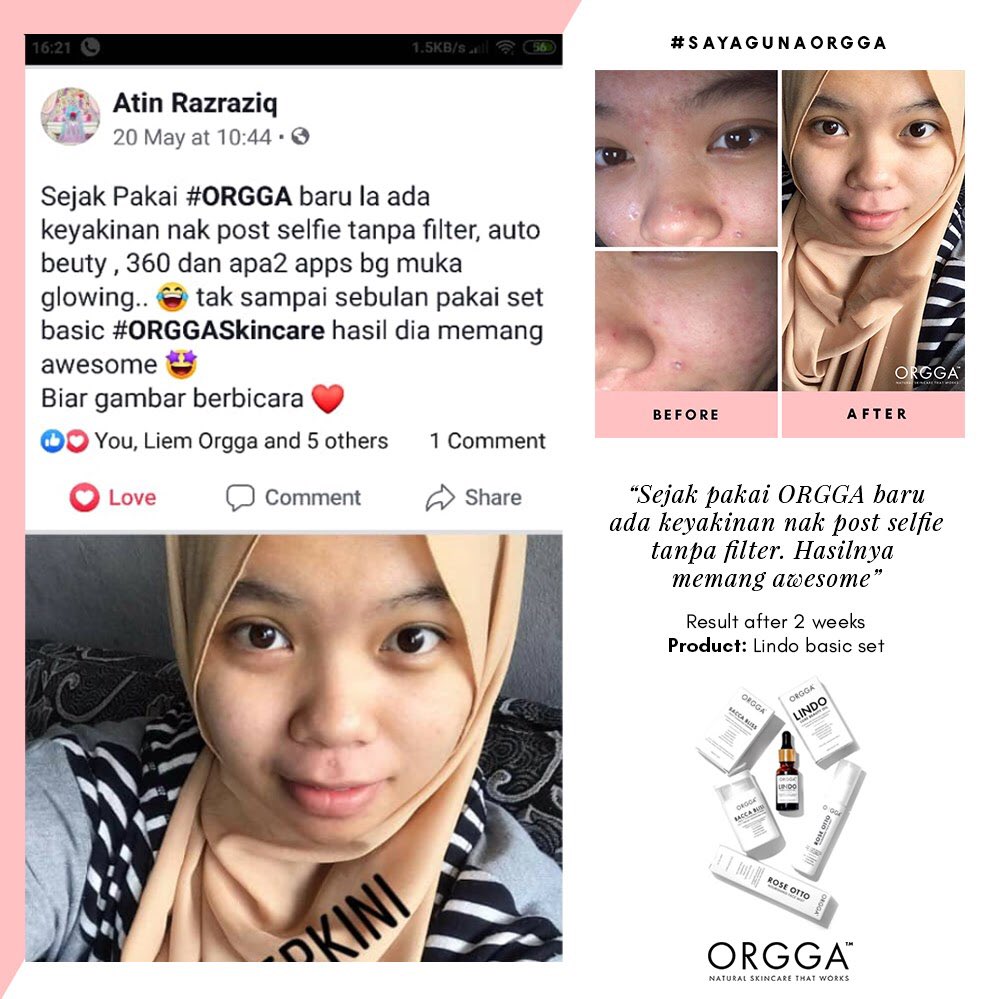 OrggaMalaysia's tweet photo. #OrggaFeedback | Atin is using our Lindo Basic Set yang memang khusus untuk acne prone + oily skin type! 😍 https://t.co/D3Kgf9smZS