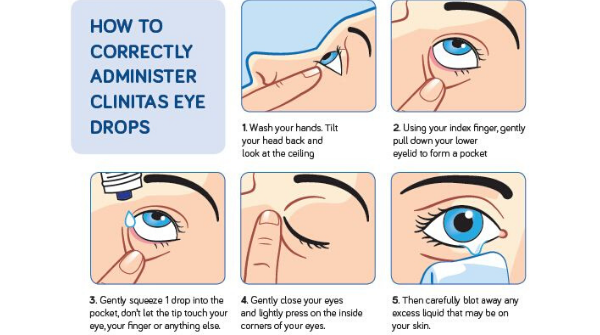 Altacor Eye Products on Twitter: &quot;How to correctly administer #Clinitas Eye  Drops https://t.co/iOtfAEaLeX https://t.co/HNpPdDIYTS&quot; / Twitter