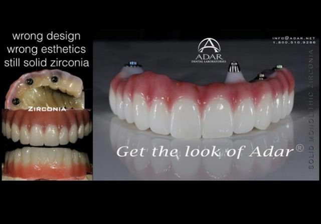 pinhasadar's tweet photo. We replace these ugly and non functional zirconia hybrids everyday in our practice.  Get it done correctly and beautifully the first time!  Your patients will love you for it.⠀
call: (800)510-9286 email: info@adar.net⠀
⠀
#AdarDentalNetwork #PinhasAda… https://t.co/wPp9A2Evyb https://t.co/p9FCLqpb71