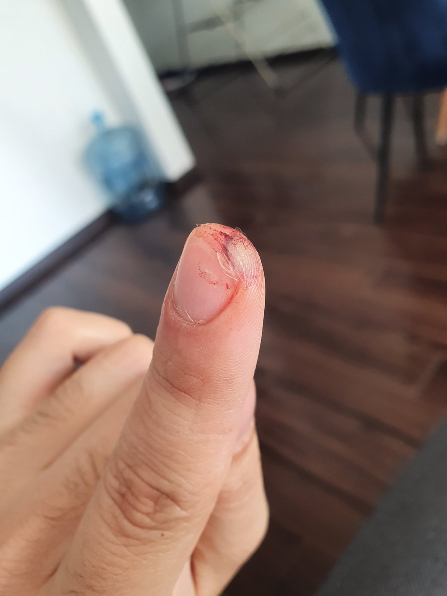 honasmelendez's tweet photo. La peor época para cortarte un dedo 👌 https://t.co/AIVtgDWwmW