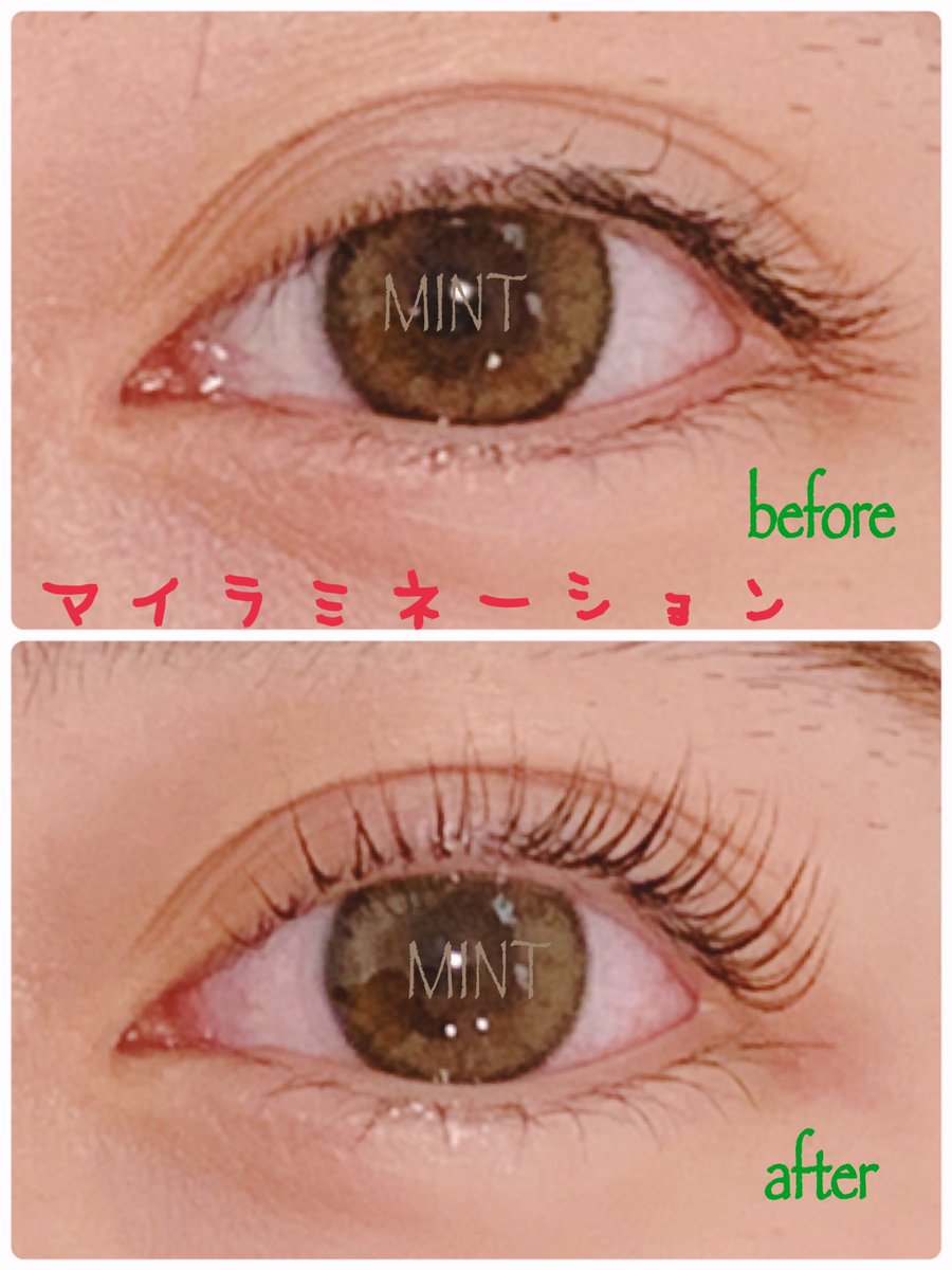 Mint Eyelash Head Spa まつ育パーマ まつ毛にボトックスinマイラミネーションが横浜 で出来るのはmintだけ 本日12時 ご予約当日予約可能 初回限定 6 000円 最軽量フラットラッシュも大好評 Tel T Co Rcnizxncwq Mint Eyelash Head Spa まつ育パーマ まつ毛にボトックスinマイラミネーションが横浜 で出来るのはmintだけ 本日12時 ご予約当日予約可能 初回限定 6 000円 最軽量フラットラッシュも大好評 Tel T Co Rcnizxncwq