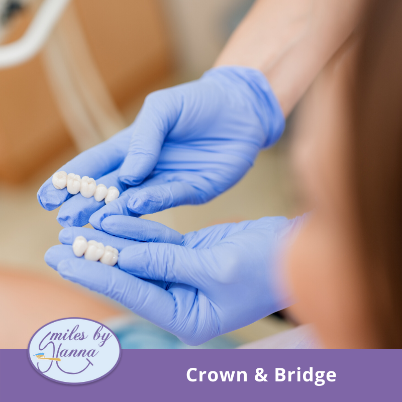 Dentist_Gilbert's tweet photo. A dental crown is a permanent “cap” that will cover the visible surfaces of your tooth, while a dental bridge consists of three or more dental crowns that have been bound together. If you have broken, decayed, or missing teeth, these are great options. Call us at (480) 582-0277 https://t.co/QBg75tlZBe