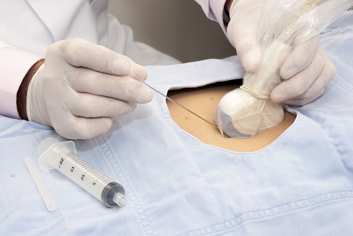 NanosonicsEMEA's tweet photo. trophon can help to reduce the risk of cross contamination when assessing patients with viral pneumonia (a feature of COVID-19) using ultrasound https://t.co/1Ne5HbcQYt #POCUS #coronavirus #COVID19 #COVID_19 #trophon #trophon2 https://t.co/bhmnRRpEhx