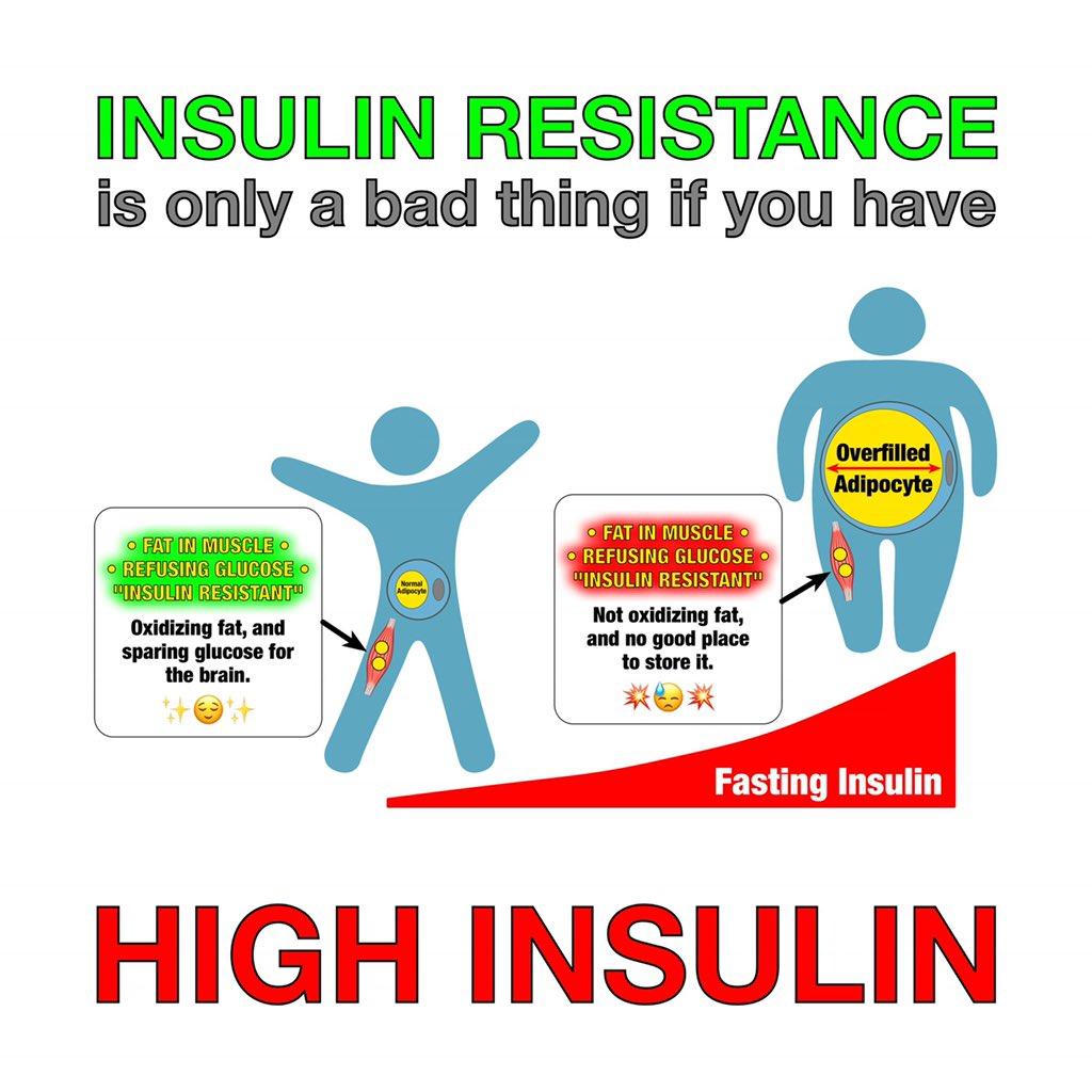 ‘INSULIN RESISTANCE’ used to be nearly synonymous with hyperinsulinemia in the medical literature, but now we all understand the major distinction between the two.In the absence of elevated insulin, this insulin resistance is perhaps better named ‘adaptive glucose sparing’.…
