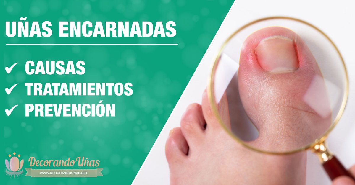 Nail Art - Uñas tweet media