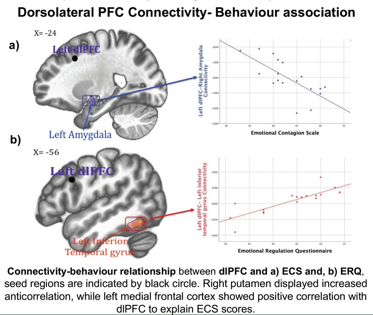 Kulpreet Cheema 4 Evidence For Double Dissociation In Brain Behavior Relationships Increased Connectivity Of Dlpfc Des Was Associated With Higher Emotion Regulation Erq While Increased Anti Correlation Of Dlpfc Was Associated With Lower Kulpreet Cheema 4 Evidence For Double Dissociation In Brain Behavior Relationships Increased Connectivity Of Dlpfc Des Was Associated With Higher Emotion Regulation Erq While Increased Anti Correlation Of Dlpfc Was Associated With Lower