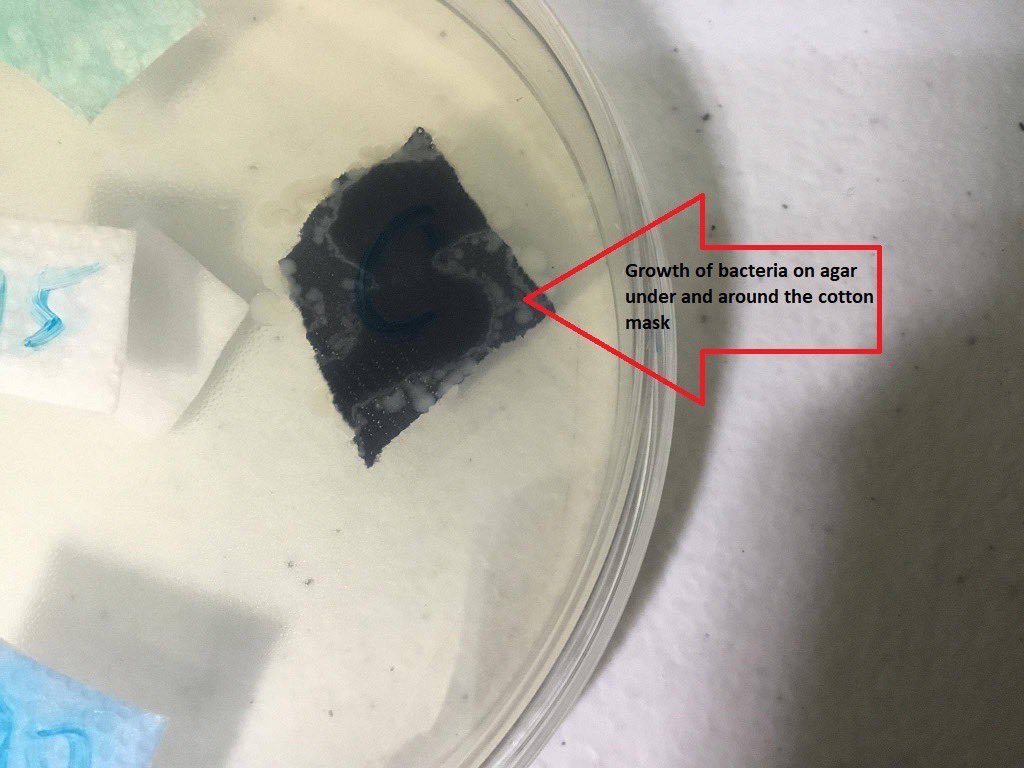 MedtechMustKnow's tweet photo. Cotton mask is not PPE!
Pics show agar plate with cut pieces of different kind of mask. A drop of saliva is still visible after 24 hours in ALL masks EXCEPT the cotton mask.  

Saliva penetrated the cotton mask allowing bacteria to grow underneath &amp; around the black cotton mask. https://t.co/nxbHWZdDOR