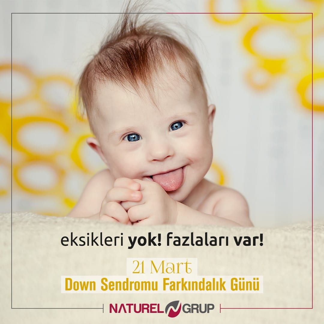 Dünya Down Sendromu Günü
Birleşmiş Milletler tarafından Down Sendromuyla ilgili bilinç ve farkındalık oluşturmak amacıyla 21 Mart olarak belirlenmiştir.
#dünyadownsendromufarkındalıkgünü #downsyndrome #naturelgrupyemek