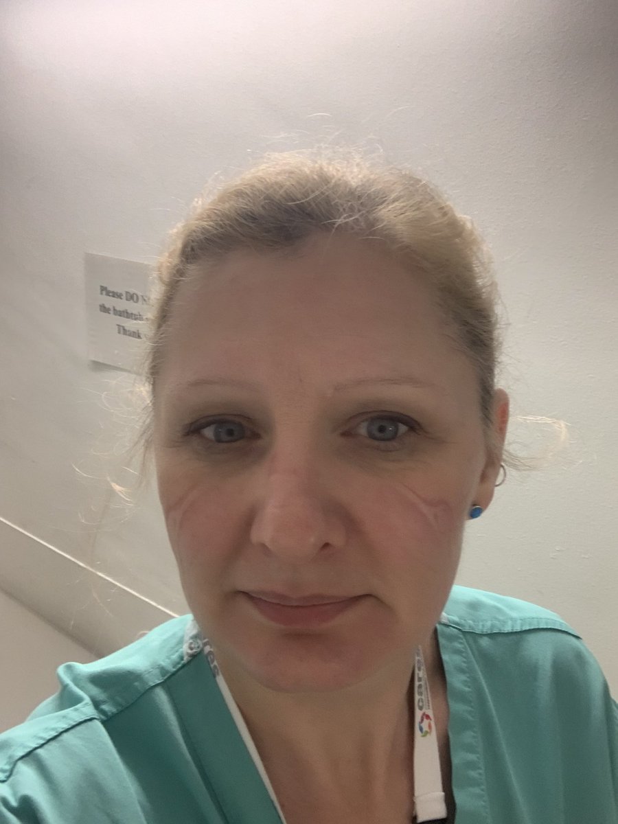 lizzys39's tweet photo. @silv24 Here’s mine from yesterday after only 4 hours https://t.co/WHrtP2xypM