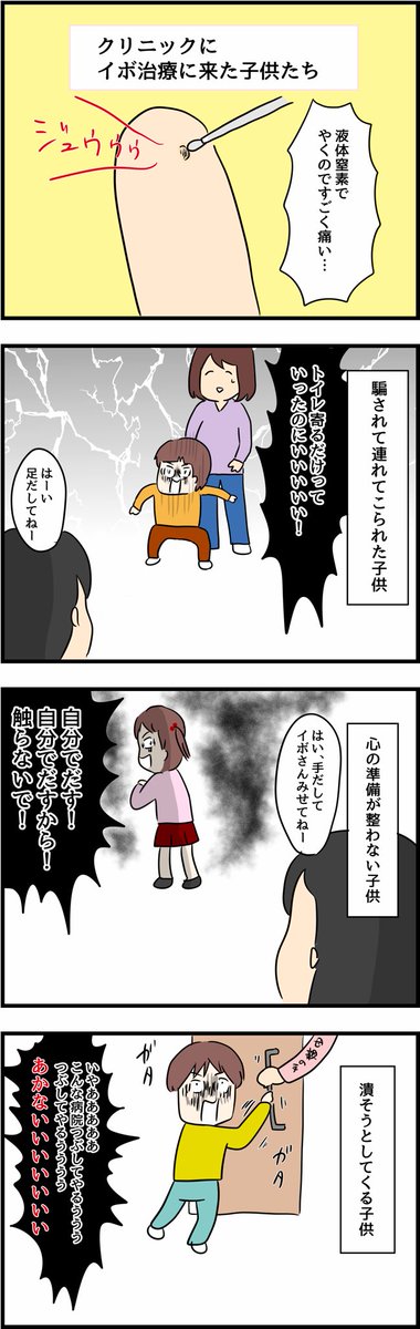 イボ治療にくる色んな子供たち 