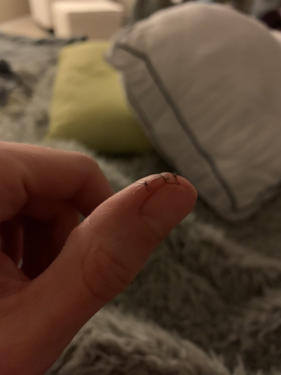 Sammyjo1110's tweet photo. Carrot can lid = 1       Sam = 0!! Like honestly who cuts themself and needs stitches opening a can of carrots!! Still hurting and painful. Wondering if tylonol will help the throbbing pain?? #leaveittome https://t.co/3RFUP3Ajqa