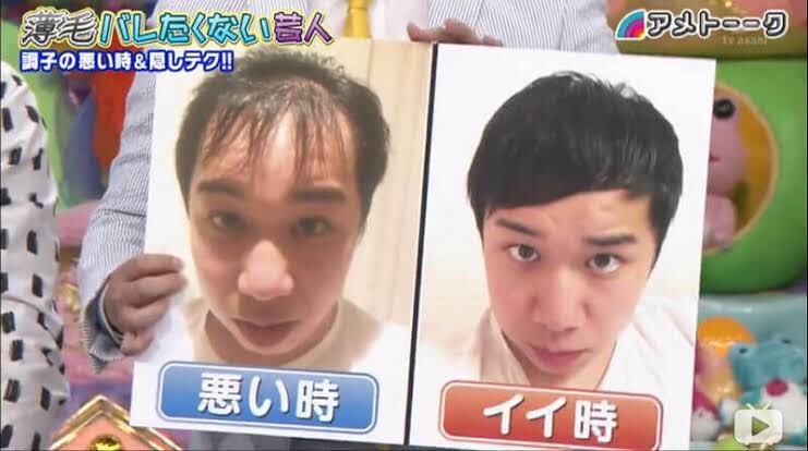 紡木 愛結 On Twitter シリアスなシーンやのに 調子悪い時の せいやの髪の毛思い出して 集中できんかったwww テセウスの船 Https T Co Molyfqhjo1 Twitter