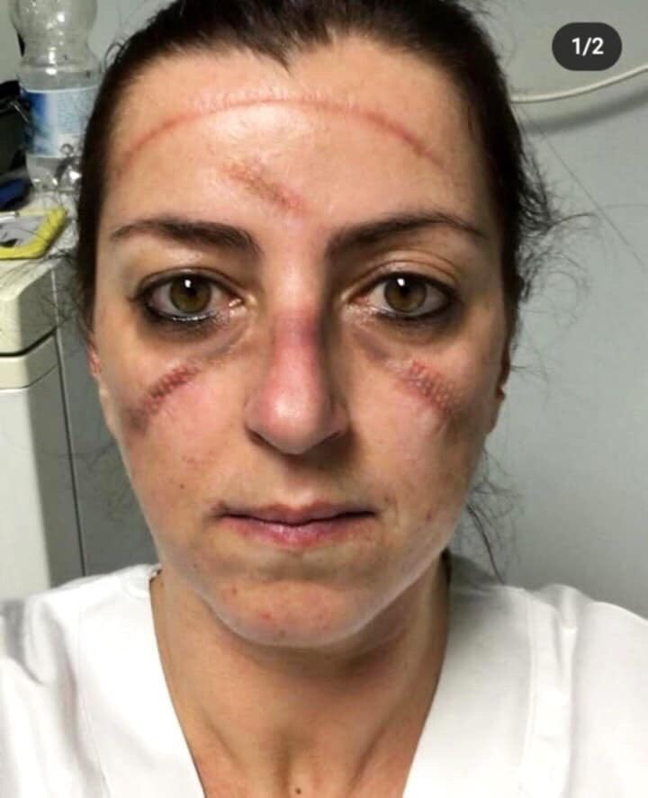 Volksburo's tweet photo. Their wounds are medals. #COVIDー19 #Italy https://t.co/tRseJnZF5I