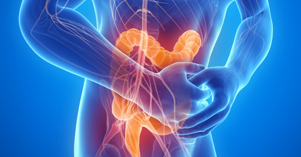 WebMD's tweet photo. Diarrhea and other digestive symptoms are the main complaint in nearly half of coronavirus patients, Chinese researchers report. https://t.co/KsECkyVFXO https://t.co/TdOWjTvp3s