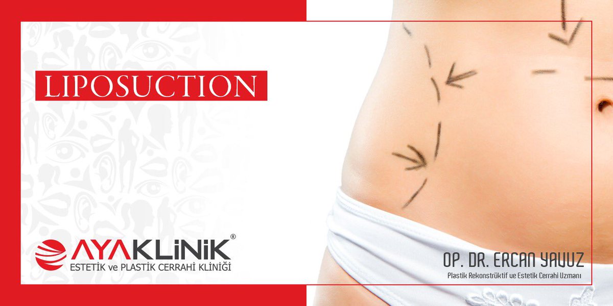LİPOSUCTİON – Liposuction/Yağ Alma işlemi en etkin ve kalıcı vücut şekillendirme yöntemidir.
0462 800 0 800 | ayaklinik.com 
#liposuction #trabzonliposuction #bölgeselzayıflama #ayaklinikliposuction #lipoliz #yağalımı #liposakşın #yağenjeksiyonu #drercanyavuz