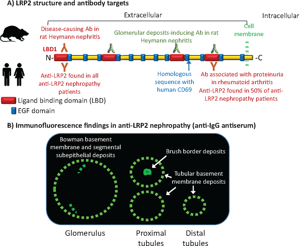 CKJsocial's tweet photo. Megalin/lipoprotein receptor-related protein 2 autoimmunity and kidney disease https://t.co/SOaE2JQLbF #CKJ #openaccess #kidneysmatter #autoimmunity2020 https://t.co/YvIpyo4cFY