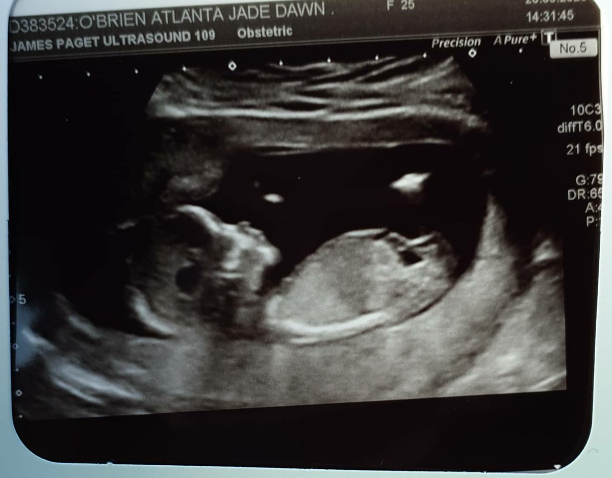 so much love for you 💖💙