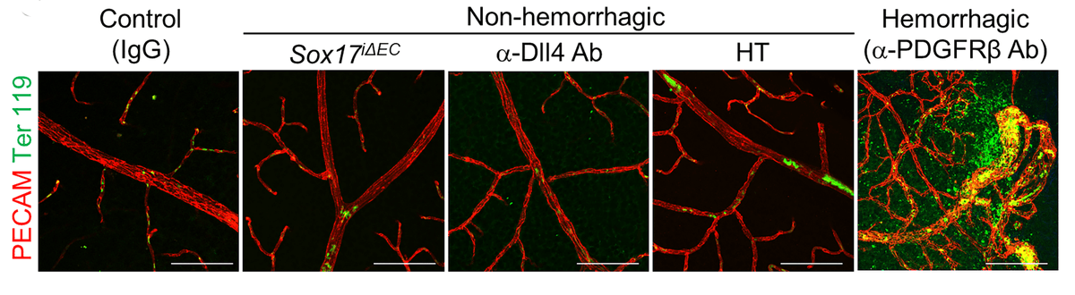 CircRes's tweet photo. #Dll4-#SREBP1 signaling in the #retina controls #transcytosis independently of #TightJunction permeability. 

Dll4 dysregulation may underlie #hypertension-induced pathological leakage of the #CNS vascular barrier. https://t.co/NEL57VS5MG https://t.co/L3GNomuQgs