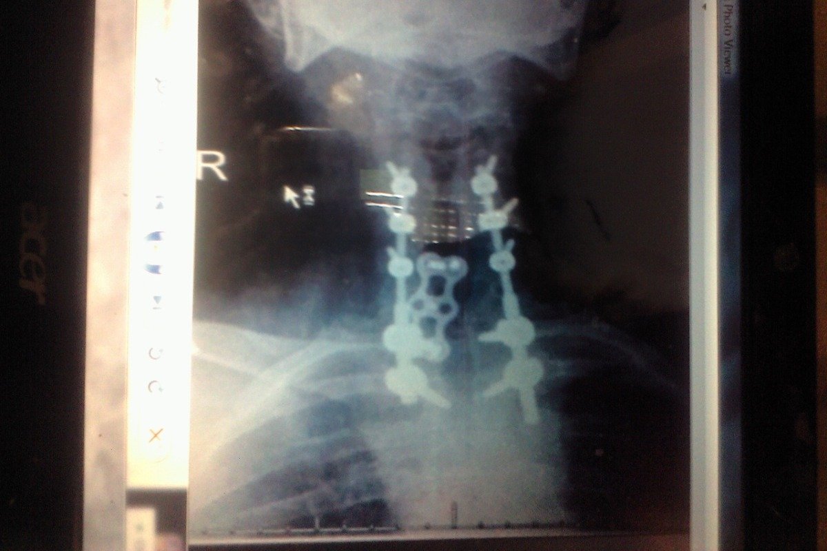 JasonRinger1's tweet image. Please support my GoFundMe campaign: gofundme.com/f/spinal-stem-… @gofundme