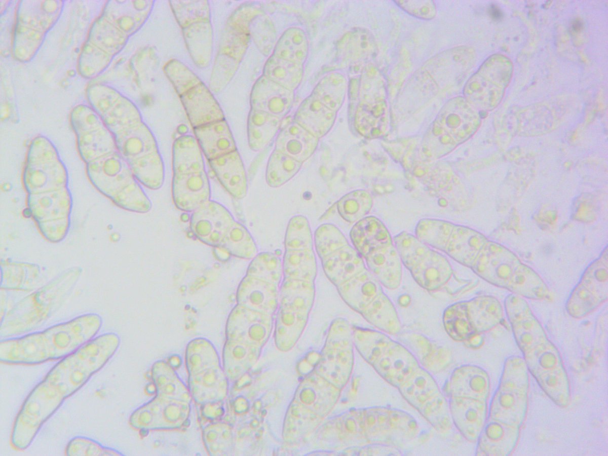 LichenicolousF's tweet photo. Stagonospora exasperatulae Brackel on Melanohalea exasperatula. New species to Ukraine.

Ternopil region

Ukraine https://t.co/6YZq8HVGW3