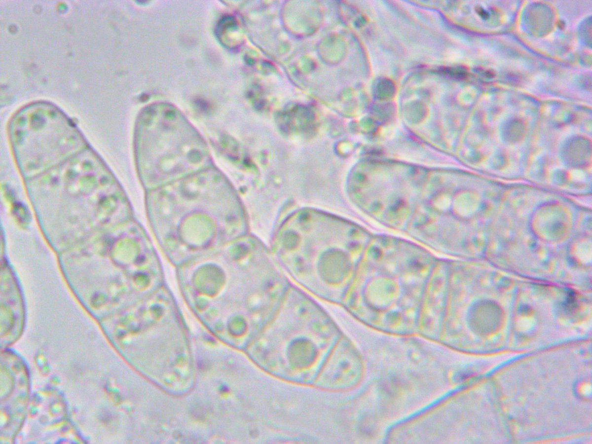 LichenicolousF's tweet photo. Stagonospora exasperatulae Brackel on Melanohalea exasperatula. New species to Ukraine.

Ternopil region

Ukraine https://t.co/6YZq8HVGW3
