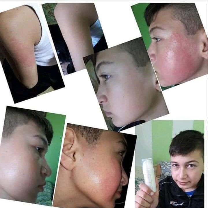 CSluijk's tweet image. Complete care cream 🥥

Deze crème is ontworpen voor alle huidtype. Door de lichte formule, is deze ook geschikt voor de kleintjes.  

Met kokosnoot 🥥 En avocado oli 🥑 Die de huid beschermen en versterken ! 

Voor 8.50,- Te bestellen via een privé bericht.