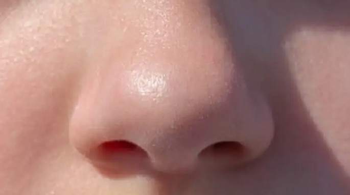 Two emerging telltale #COVID19 symptoms that everyone should know about: 1)Eyes hurt [30%] 2)Can't smell (#anosmia) or taste (#ageusia) [&gt;50%]. Add that to the triad of #fever #shortnessofbreath #cough that we know so well. <a href="/CarlosdelRio7/">Carlos del Rio</a>'s AM screen-take temp &amp; smell coffee