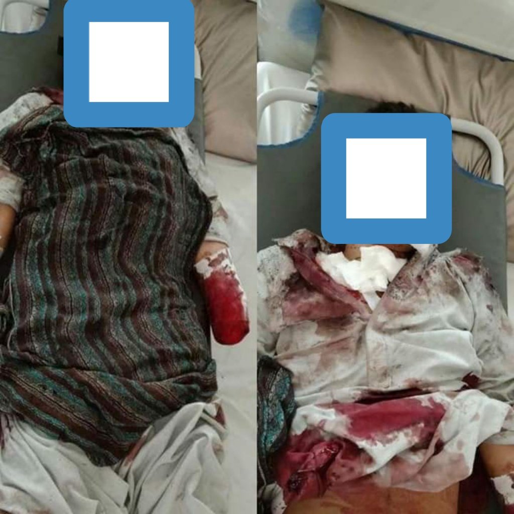  #Landmine blast in  #Shakai area of ​​ #SouthWaziristan In injured childrens1 Ehsanullah age13 years 2. Farhad age 8 years 3. Syed age 9 years4. Tahir age 12 years old.Okay let's speak about  #Kashmir