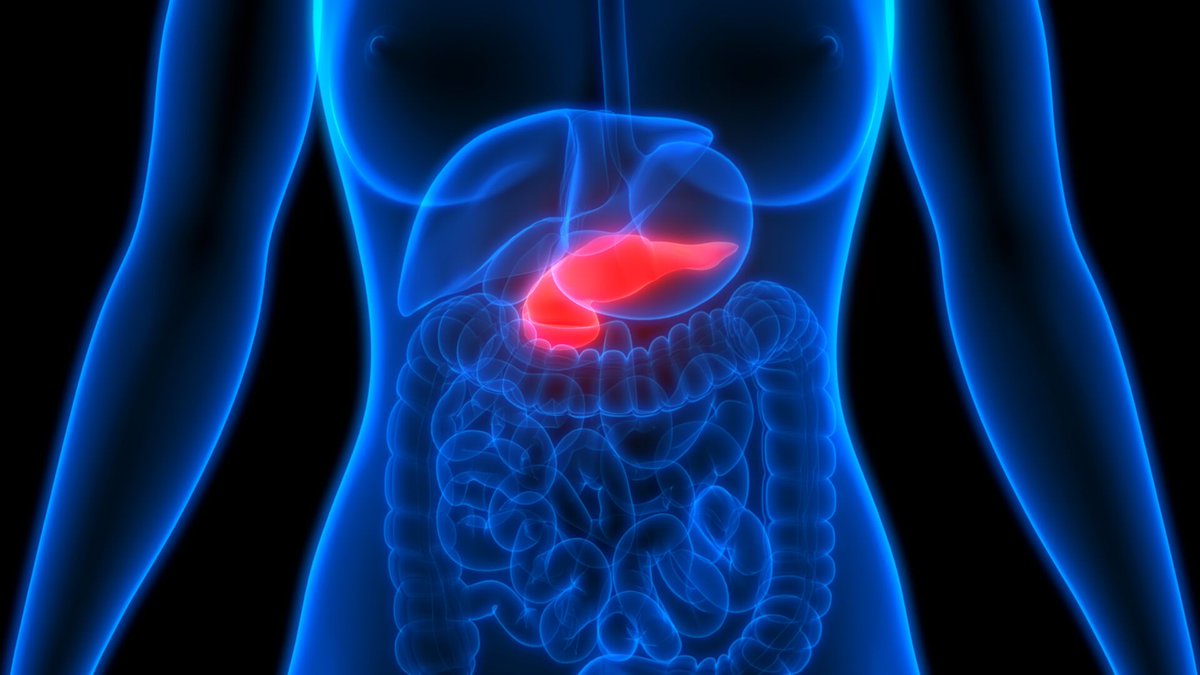 ESIsrael21c's tweet photo. #Cancer de #pancreas: una molécula logra destruir células malignas. Un estudio realizado en ratones en #Israel mostró una reducción del 90% de elementos cancerosos después del tratamiento con el novedoso hallazgo. https://t.co/lKSio2YCon https://t.co/yHIPstMbWG