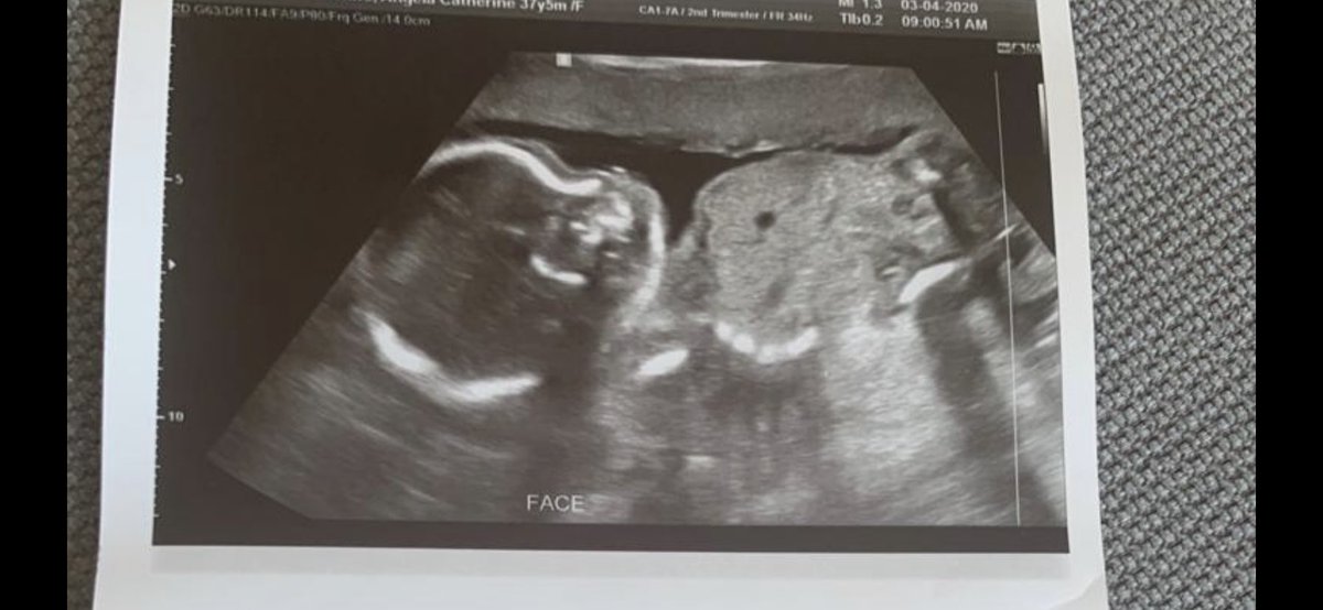 Lee Merricks tweet media