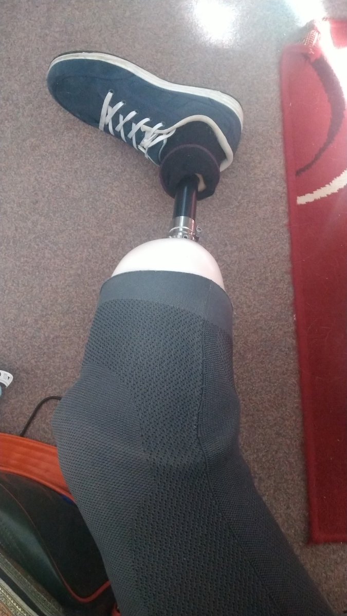 VincentKStoker's tweet photo. I got my leg and had no physio thanks to closure and lock down. Bit by bit I have managed to work things out at home. I can now manage nearly a full day wearing and am walking well. #amputee #amputeelife #amputation #newbeginnings #belowkneeamputation https://t.co/x8DwH5xCt2