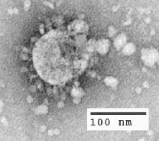 To understand this, we need to talk about particle sizes. You probably know that the coronavirus is small – after all, you can’t see them. They in fact are very small – each virus has a diameter of 125 nanometers, or nm for short. Here’s a picture of one under a microscope.