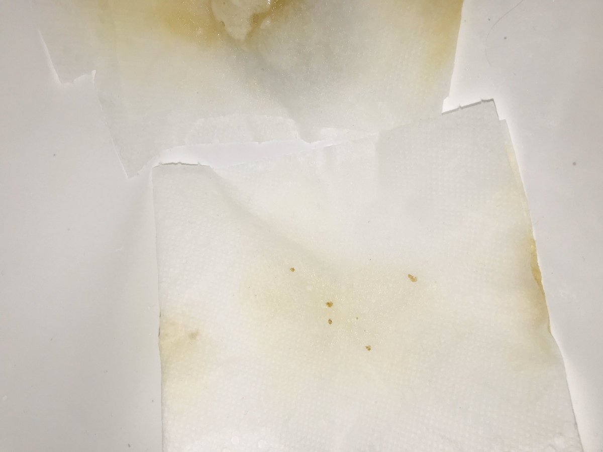 cefiedlerdog's tweet photo. I’m not a bio chemist but had many classes.  So compound that is reliant on its protein makeup to survived Cov19 SARS etc. any compote that has free Hydrogen radicals available will disable spread and kill? Thus. Hydrochloriquen and zpack. Hyperoxide 3secs. https://t.co/YAi0509u9N