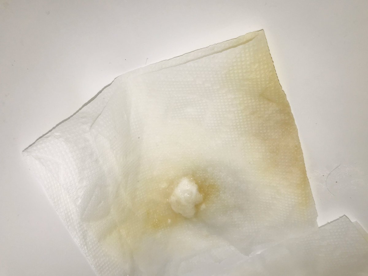 cefiedlerdog's tweet photo. I’m not a bio chemist but had many classes.  So compound that is reliant on its protein makeup to survived Cov19 SARS etc. any compote that has free Hydrogen radicals available will disable spread and kill? Thus. Hydrochloriquen and zpack. Hyperoxide 3secs. https://t.co/YAi0509u9N