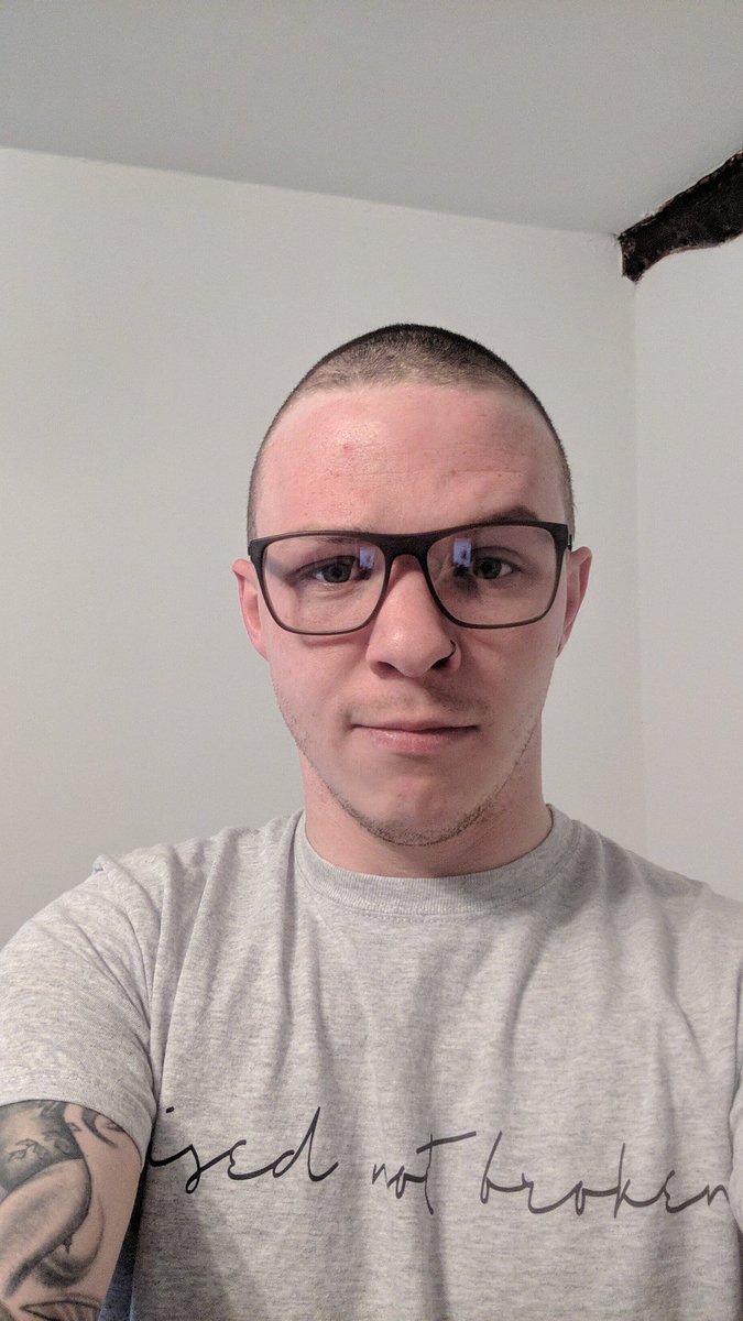 UnclottableUK's tweet photo. And the hair is gone! Find the video on Facebook and YouTube! https://t.co/rApaZIEfPR
#unclottable #haemophilia #bleedingdisorders #haemophiliaawareness #saveforshave https://t.co/JzXQw6aaPZ