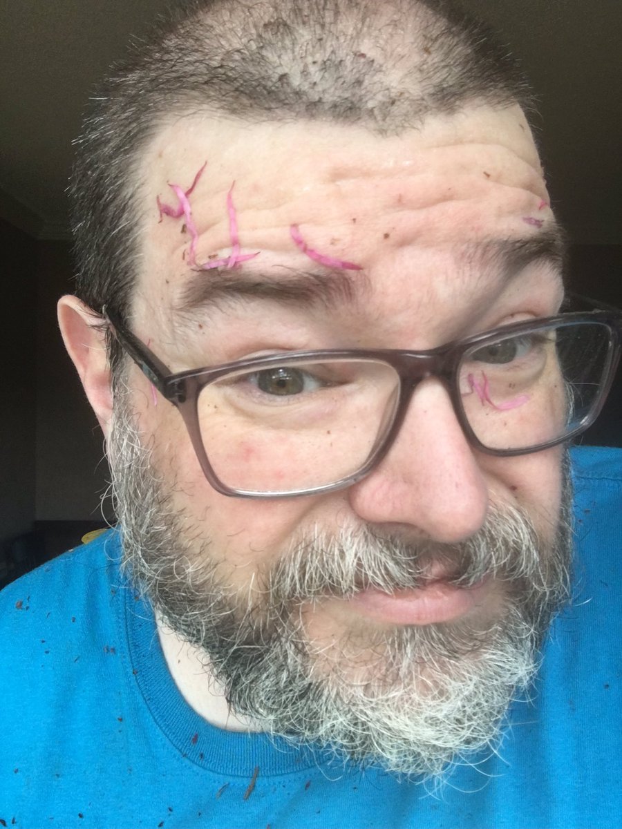 marcmonroebooks's tweet photo. No, it’s not makeup. No, I’m not bleeding. I was pruning crape myrtle trees. #crapemyrtle #notmakeup #leaves #blackthumb https://t.co/s7TNS1cnzO