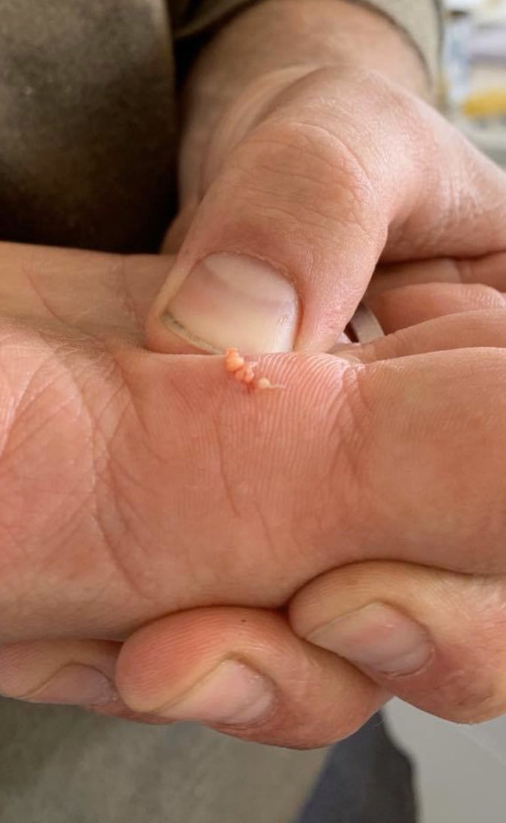 Martin Rosenbæk tweet media