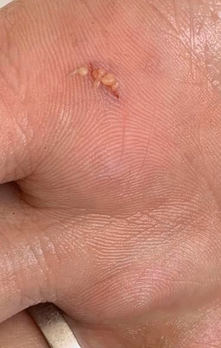 Martin Rosenbæk tweet media