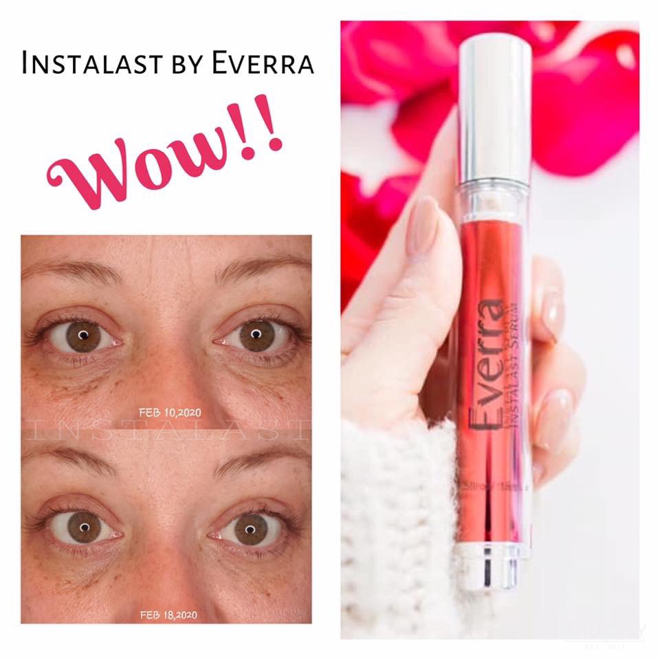 SharonCopperwh1's tweet photo. Instalast works instantly to tighten fine lines and eye bags this is an absolute must have!!! #everra #instalast #tightens #firms #amazing #musthave https://t.co/XZJtK1kzbn