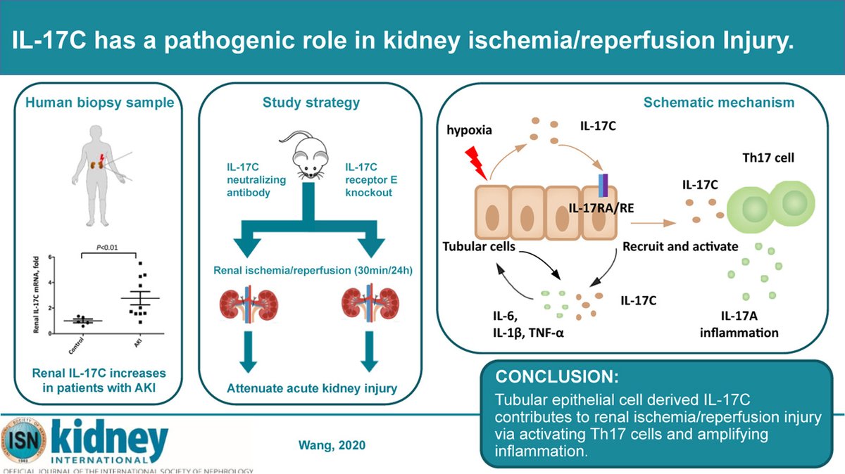 #GraphicalAbstract
doi.org/10.1016/j.kint…
@sjtu1896 #AKI #IschemiaReperfusion