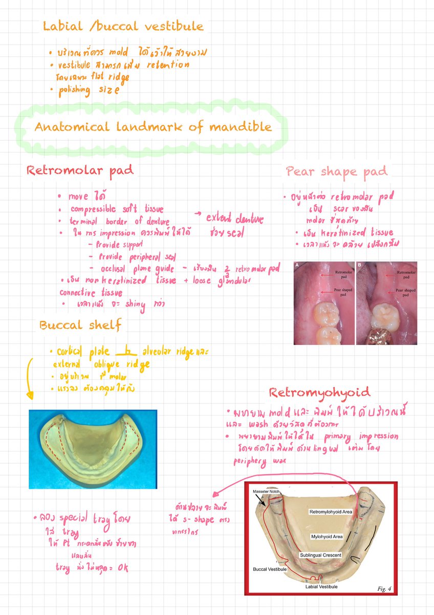 fonkansiri's tweet photo. Anatomical ที่ต้องดูในฟันบนล่าง ประเมิน vibrating line แยกanterior vibrating line ให้ออกเสียง อา แรงๆ อยู่ประมาณรอยต่อ hard กับ soft palate แต่ posterior vibrating lineให้ออกเสียง อา เบาๆ อยู่ใน soft palate รอยต่อที่ moveable และไม่ moveable, PPSA กับ PPS ต่างกันไง #ADResident1 https://t.co/MEbuaKBcVI