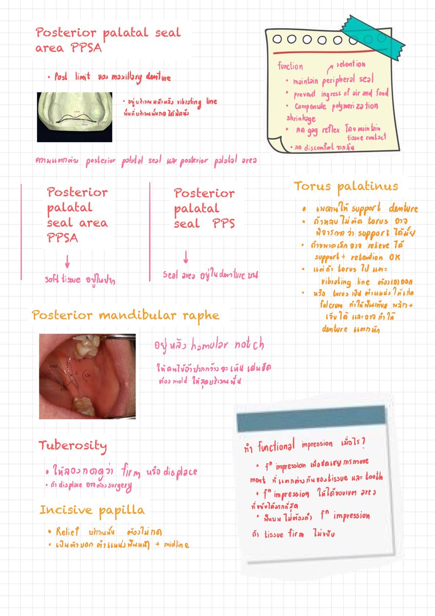 fonkansiri's tweet photo. Anatomical ที่ต้องดูในฟันบนล่าง ประเมิน vibrating line แยกanterior vibrating line ให้ออกเสียง อา แรงๆ อยู่ประมาณรอยต่อ hard กับ soft palate แต่ posterior vibrating lineให้ออกเสียง อา เบาๆ อยู่ใน soft palate รอยต่อที่ moveable และไม่ moveable, PPSA กับ PPS ต่างกันไง #ADResident1 https://t.co/MEbuaKBcVI