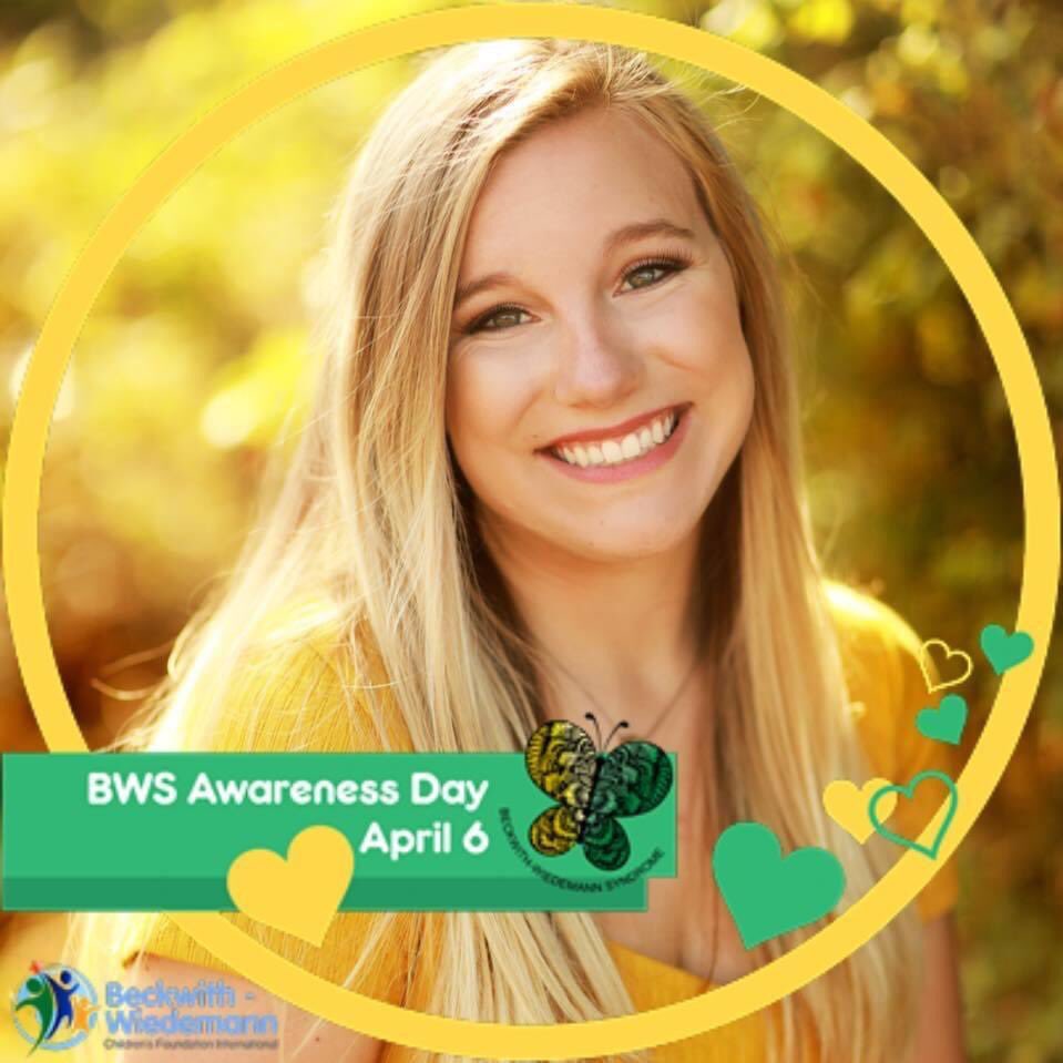 EricStreetman's tweet photo. #BeckwithWiedemannSyndromeAwarenessDay #BWSAD2020 @BWSyndrome @BwsNetwork #bwcfi #IAMBWSAWARE @AmericanCancer @CUREchildcancer @CancerDotNet #howbigbws #morethan4 #hemihypertrophy #hyperinsulinism #chromosome11 #pediatriccancer #childhoodcancer #thesmallc #gogold ππππ https://t.co/DrhT2MYi2I