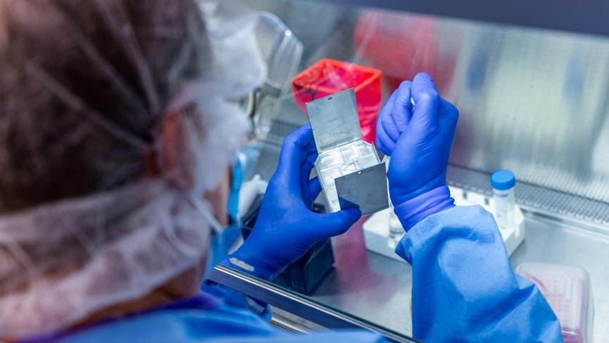 Ankara Üniversitesi: "Üniversitemiz Biyoteknoloji Enstitüsü Müdürü Prof. Dr. Aykut Özkul, koronavirüse karşı serum, aşı ve ilaç üretmenin ilk adımı olan SARS-COV-2 virüsünü izole etmeyi başardı!"