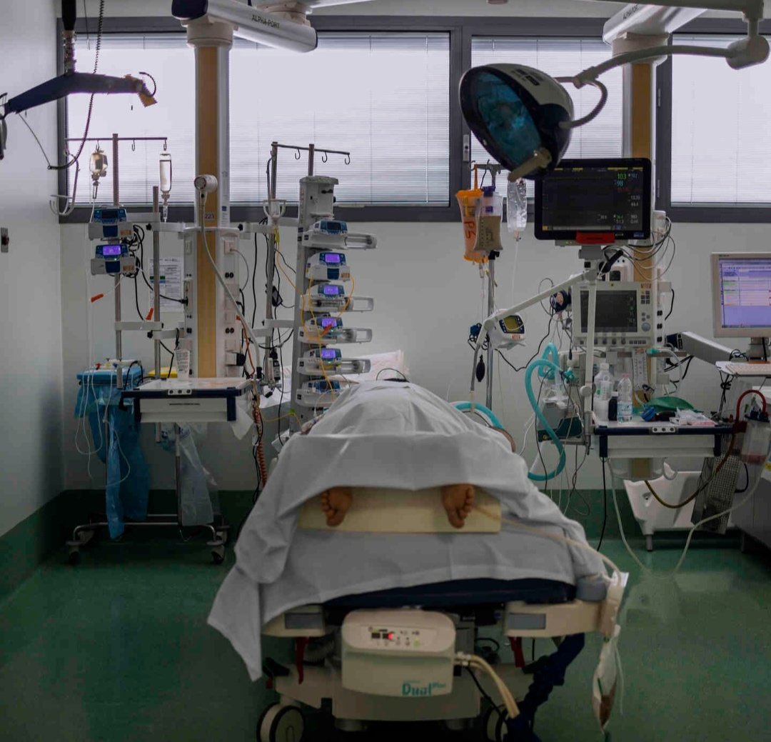 Keadaan di hospital di Bergamo sangat sibuk. Semua katil di unit ICU penuh dengan pesakit COVID-19. Para doktor dan jururawat keletihan serta takut dijangkiti virus. Doctors turn many patients onto their stomachs to relieve pressure on their lungs