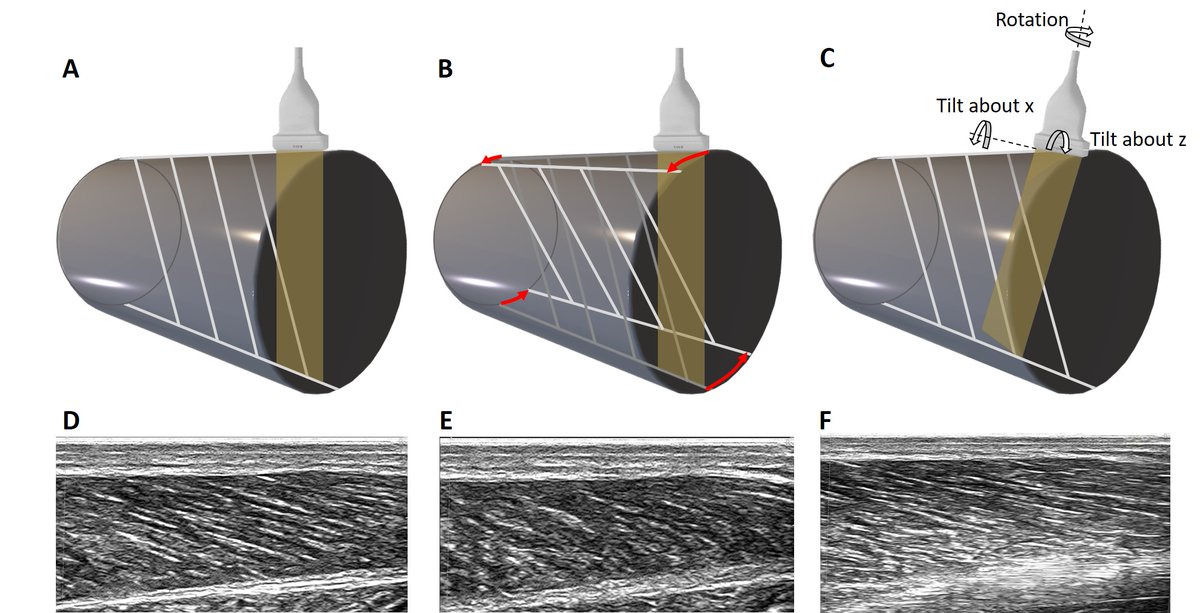 BasVanHooren's tweet photo. New FREE paper: Ultrasound imaging to assess skeletal muscle architecture during movements: A systematic review of methods, reliability, and challenges
Freely available here: https://t.co/9Nvrks8v2V
More info in thread below⬇️
#muscle #ultrasound #architecture #fascicle https://t.co/Fug0wUY7WF