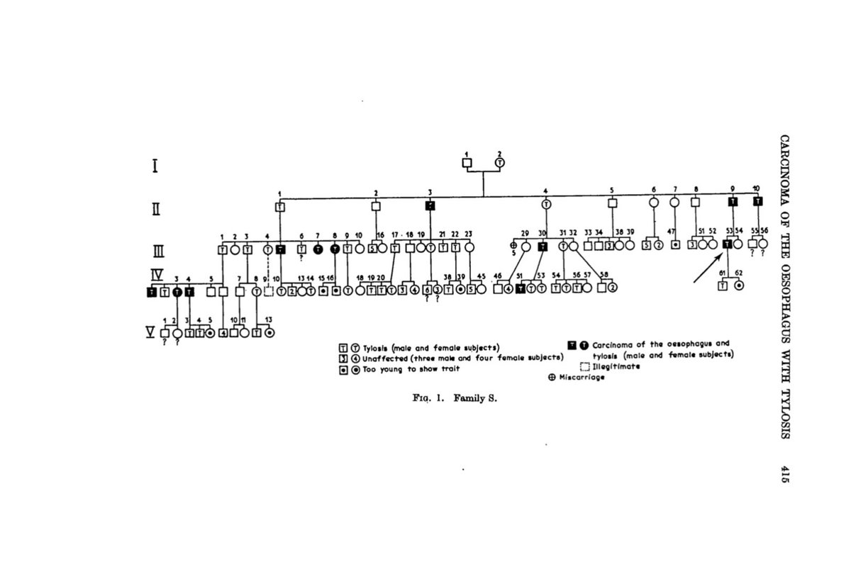 PerelmansPearls's tweet photo. Today’s #MedHxMonday is the 1st in #April ➡️#EsophagealCancerAwareness month let’s look back at #Howel–Evans syndrome aka #Tylosis w/ #EsophagealCancer described in 🇬🇧 1958 (19page paper <15 ref!)
1. Rare, AD, RHBDF mutation Ch17
2. 95% get EC by 65yo
3. EGD screening suggested https://t.co/D0tRV1OBvn