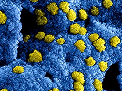 Fysiotherapeutische revalidatie in de eerstelijn na COVID-19 en IC opname #fysiotherapie fysiotherapiewetenschap.com/expert-opinion…