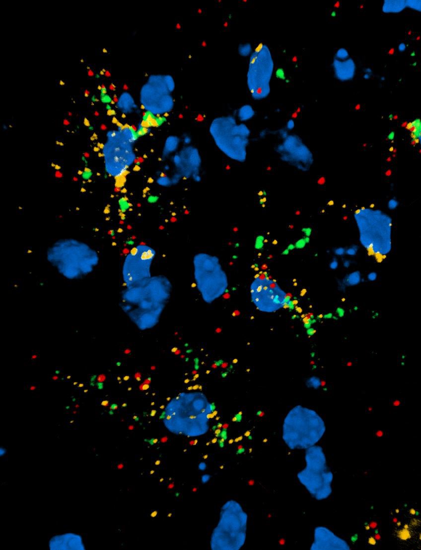 ridleyish's tweet photo. The true identity of these #cells is a SECRET. They are in witness protection as they have seen some true crimes on the cutting floor of the cryostat. #rnascope #smfish #missyoulab ⁦@Cambridge_Uni⁩ #AcademicTwitter #confocal #isthishowyoutweet? https://t.co/IbOWk2V57b