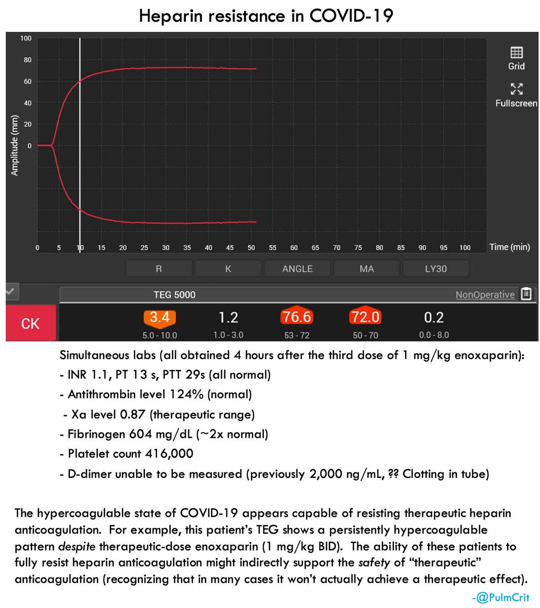 continuing to see crazy pro-coagulable states in COVID-19, for example patients breaking straight through therapeutic dosing of heparin  (#1/3) #COVID19foam